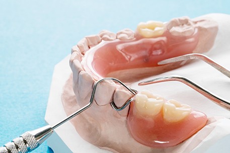 partial dentures sitting on a plaster model of a mouth