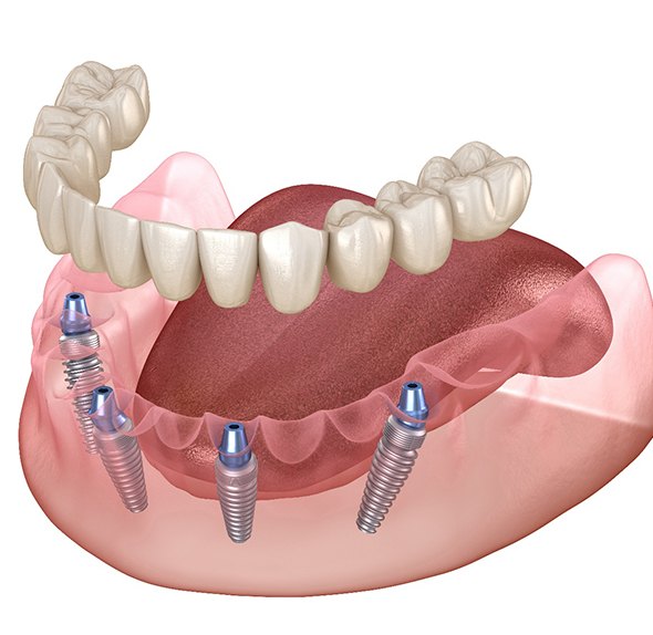 Senior woman sitting in dental chair with hands folded