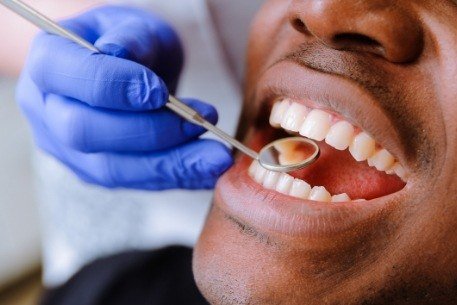 Dentist examining patient's smile after composite filling treatment