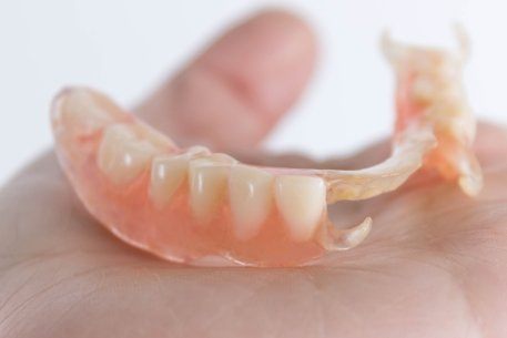 Hand holding a temporary acrylic removal partial denture