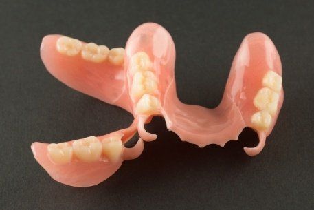 Set of flexible framework partial dentures