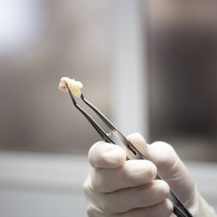 Dentist holding a tooth with forceps