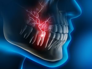 Model of a toothache