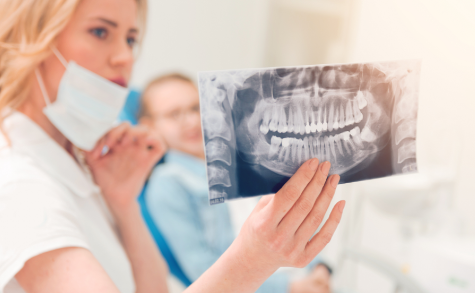 Dentist holding x-ray of wisdom teeth