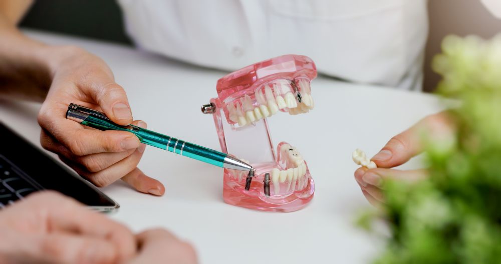 A model of dental implants in a jaw