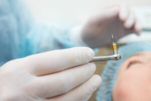 A dentist holding a titanium dental implant