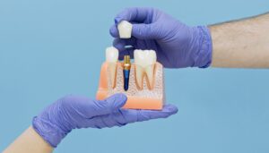 Blue-gloved hands holding sample dental implant and crown